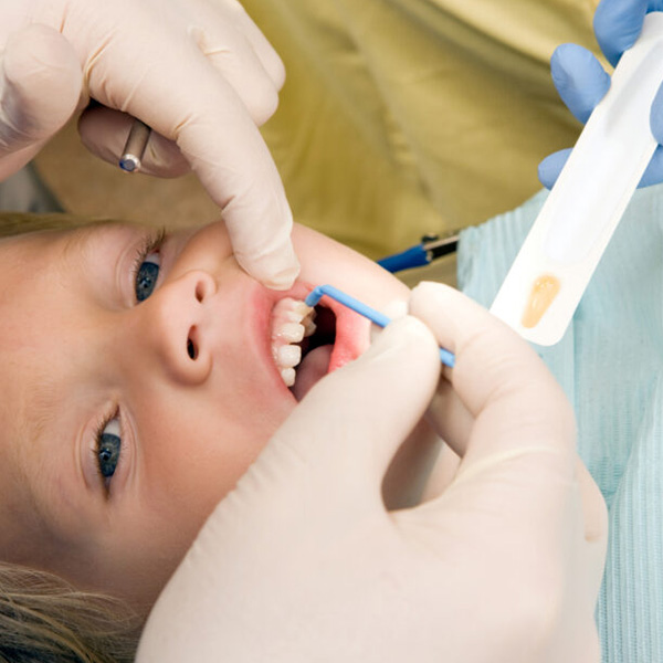 Little girl getting fluoride treatment