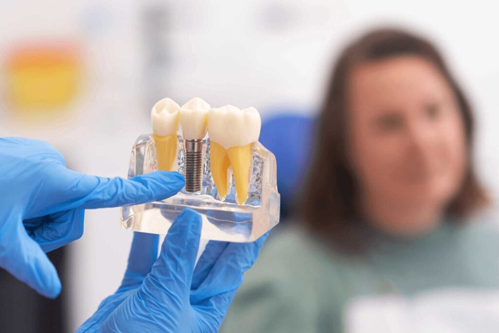 Dental implants