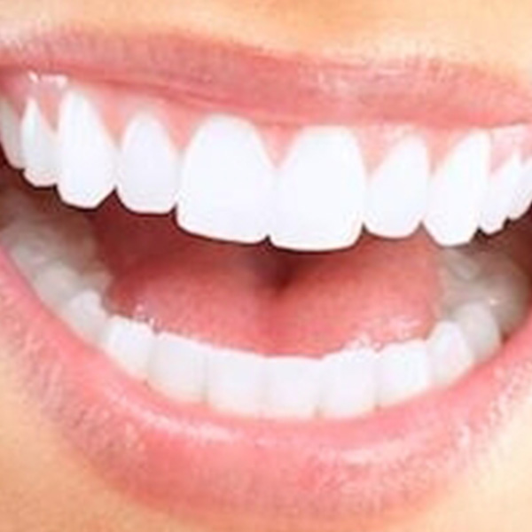 Woman smiling showing her white teeth