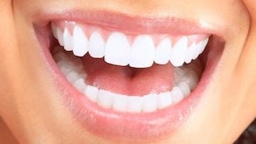 Woman showing her teeth
