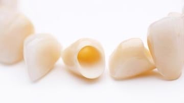 Dental crowns
