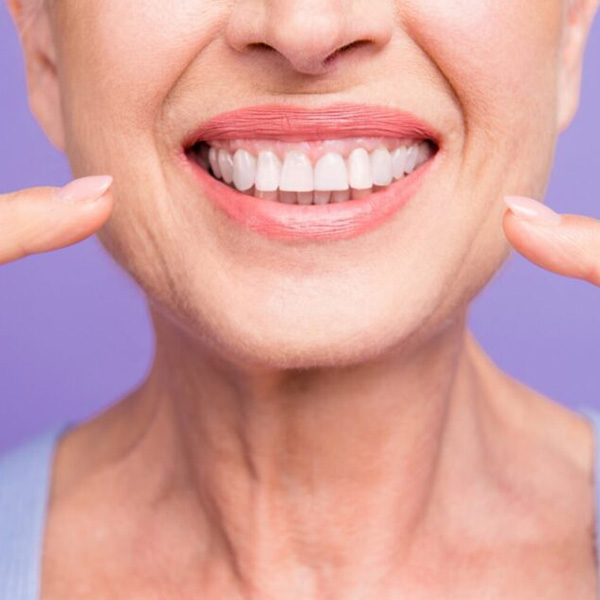 Woman smiling showing her white teeth