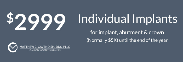 Individual implants