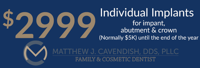 Individual Implant Coupons at Matt Cavendish, DDS, PLLC