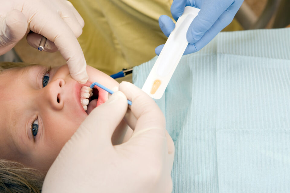 Fluoride Treatment in Phoenix, AZ