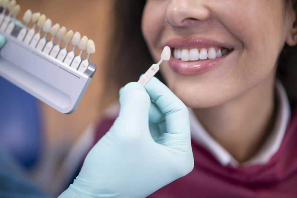 Dentist matching shade of a CEREC crown for a patient in Northern Phoenix, AZ