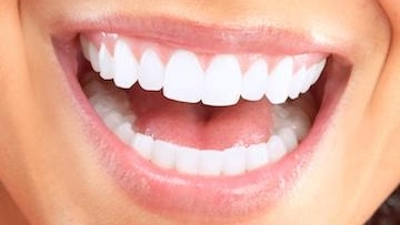 Gum Contouring Surgery in Phoenix, AZ
