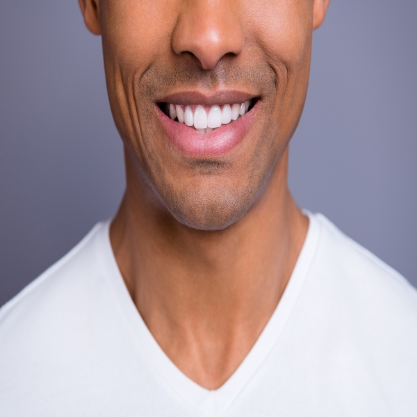 Young man restored smile concerns with dental white fillings in Northern Phoenix, AZ