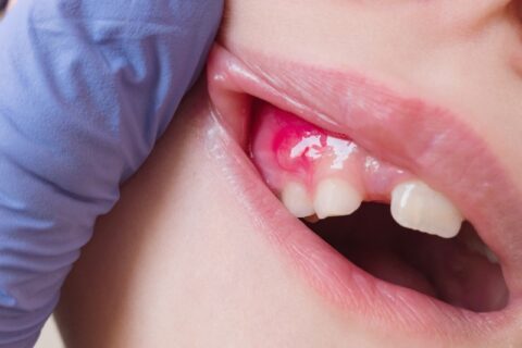 A kid fighting with tooth extraction infection in North Phoenix, AZ