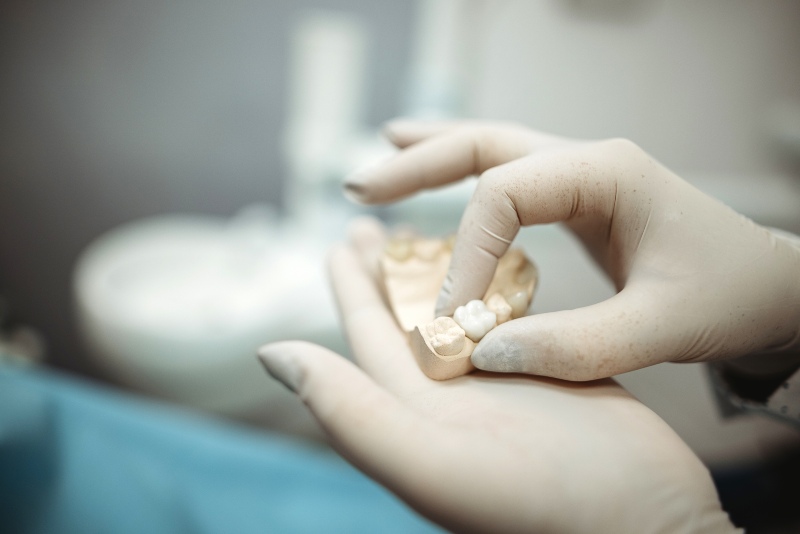 A dentist in North Phoenix, AZ, explaining how untreated bone loss can lead to tooth loss.